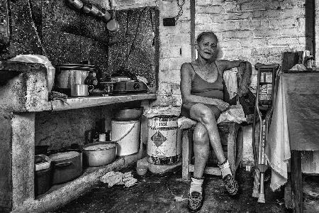 Maria, polio victim / Central Cuba