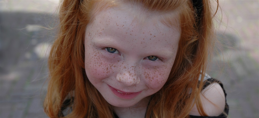 Freckled young lady von Huib Limberg