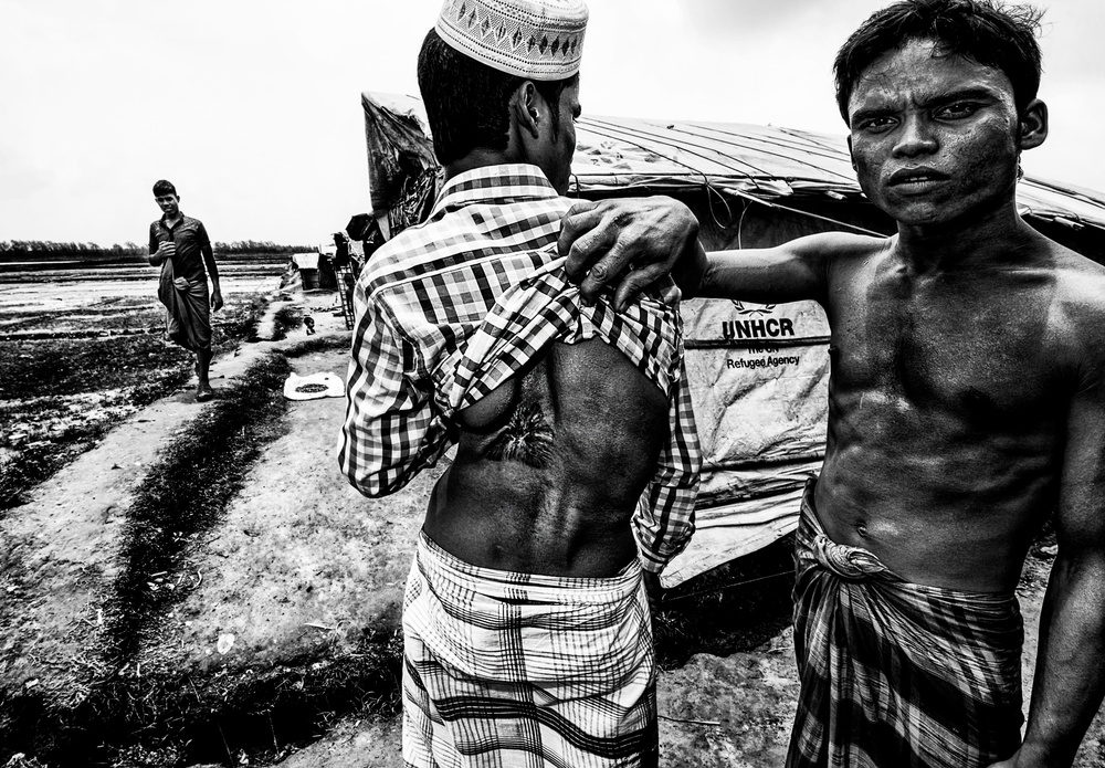 Rohingya refugee showing the impact of a bullet in his friend´s body - Bangladesh von Joxe Inazio Kuesta Garmendia