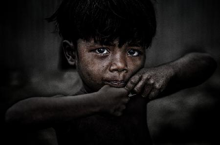 Rohingya refugee child - Bangladesh