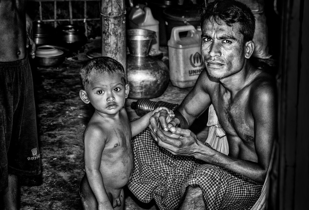 Rohingya refugee father and his son - Bangladesh von Joxe Inazio Kuesta Garmendia